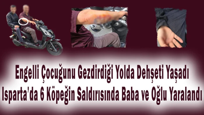 Engelli &Ccedil;ocuğunu Gezdirdiği Yolda Dehşeti Yaşadı! 6 K&ouml;pek Saldırdı