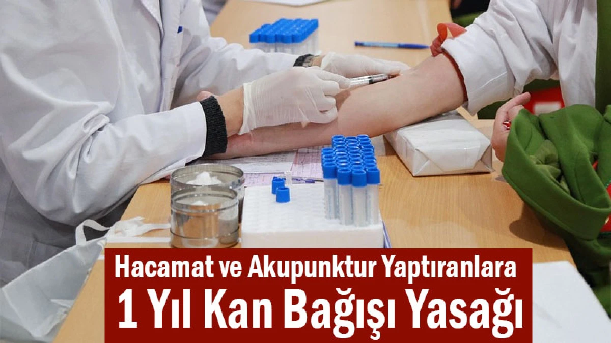 Hacamat, Akupunktur Yaptıranlara 1 Yıl Kan Bağışı Yasağı